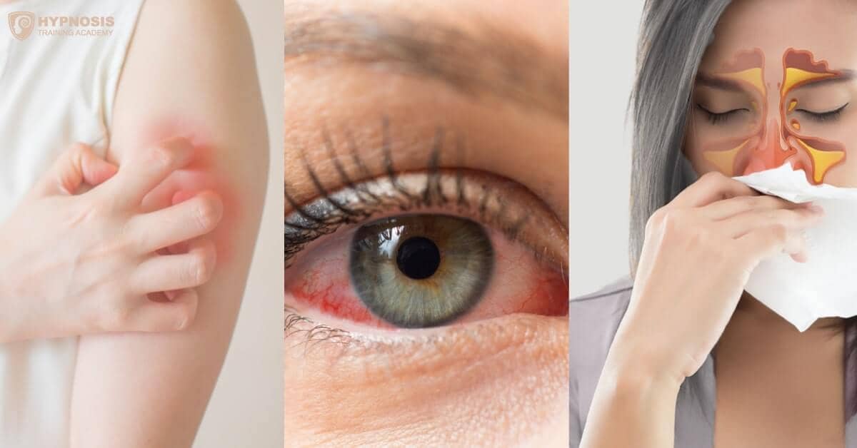 Hypnosis For Allergies How To Naturally Relieve