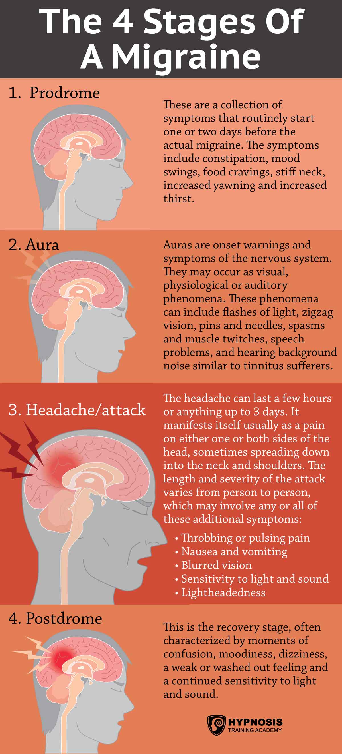 What Are The Symptoms Of Migraines?